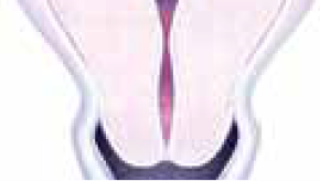 cervical canal