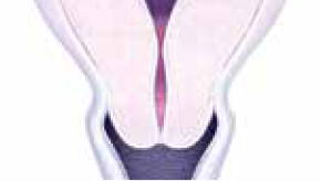 cervix