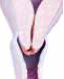 Inhospitable cervical mucus