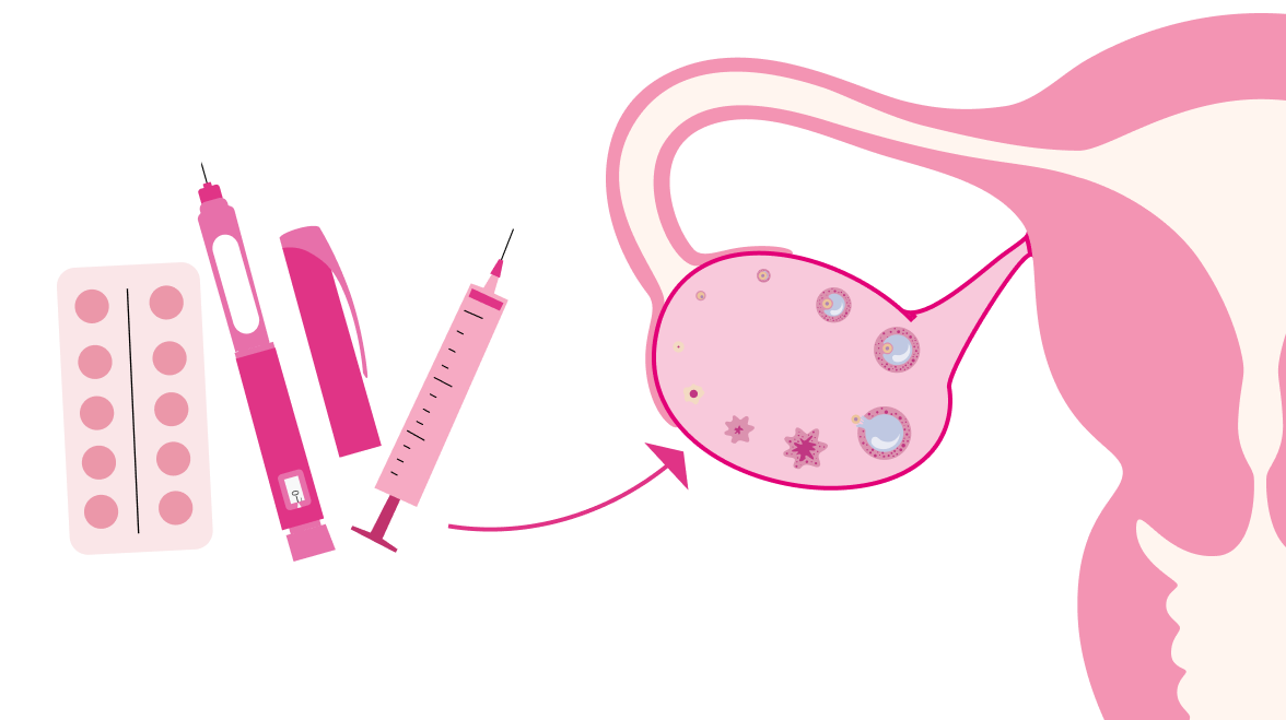 Ovulation induction illustration