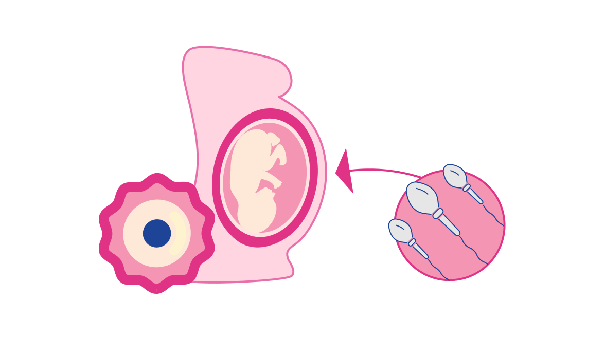 Traditional Surrogacy illustration